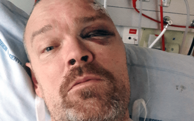 Kenneth fik ar i hjernen